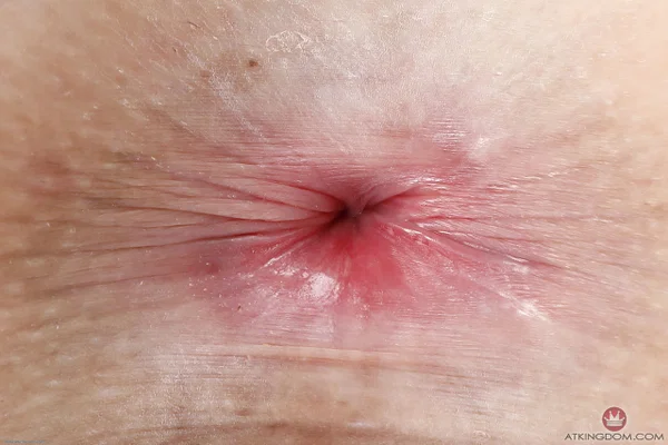 ATK Galleria performed by Rosalyn Sphinx Hot Images  - Spreading, Amateur, Big Clit, Pussy, Petite, Anal, Ass, Shaved, Close Up, Tiny Tits  - Photo 20