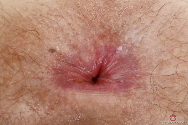 Hairy teen Mercy West displays her tight ass and pink pussy while totally naked  - Hairy, Pussy, Petite, Skinny, Close Up, Teen, Short Hair, Big Clit, Amateur, Spreading  - Photo 20