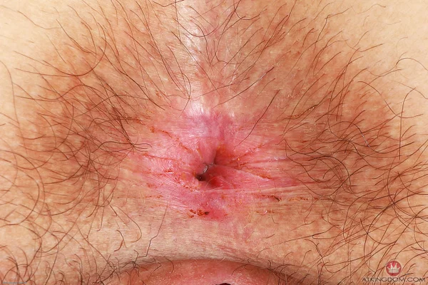 ATK Hairy performed by Gigi Naked XXX  - Hairy, Asshole, Amateur, Ass, Redhead, Close Up, Spreading, Outdoor, Panties, Pussy  - Photo 21