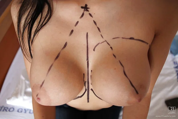 Aletta Ocean goes through successful plastic surgery operation  - Pornstar, Big Tits, Fake Tits, Schoolgirl  - Photo 3