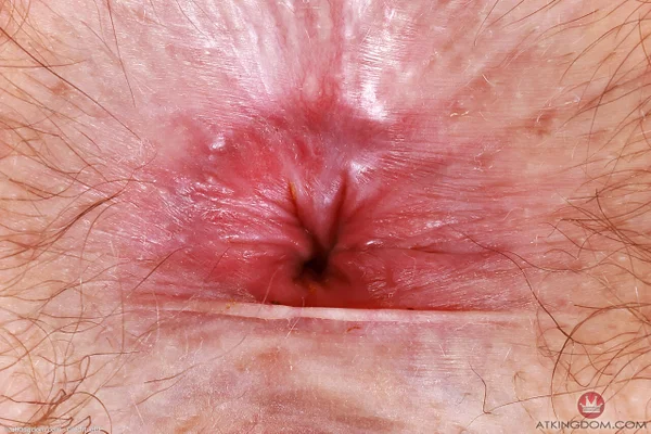 ATK Hairy starring Big Eyes Hot XXX  - Hairy, Petite, Ass, Asshole, Upskirt, Anal, Armpit, Big Clit, Non Nude, PAWG  - Photo 21